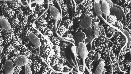 Human sperm cells. Each tadpolelike sperm cell consists of three regions: the head, middle piece, and flagellum. (Photograph by Fawcett/Philips. Reproduced by permission of Photo Researchers, Inc.)